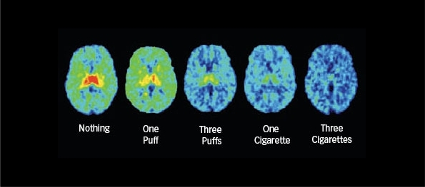 cigarettes-effects-brain